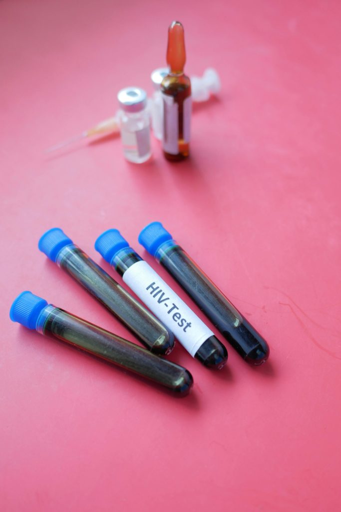 HIV testing the base for everything