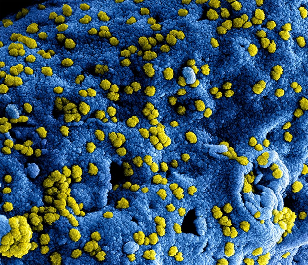 WHO Ebola outbreak response in Congo and Uganda 2026