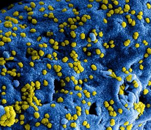 Ebola Emergency in Congo and Uganda Amid Rising Cases (2026)